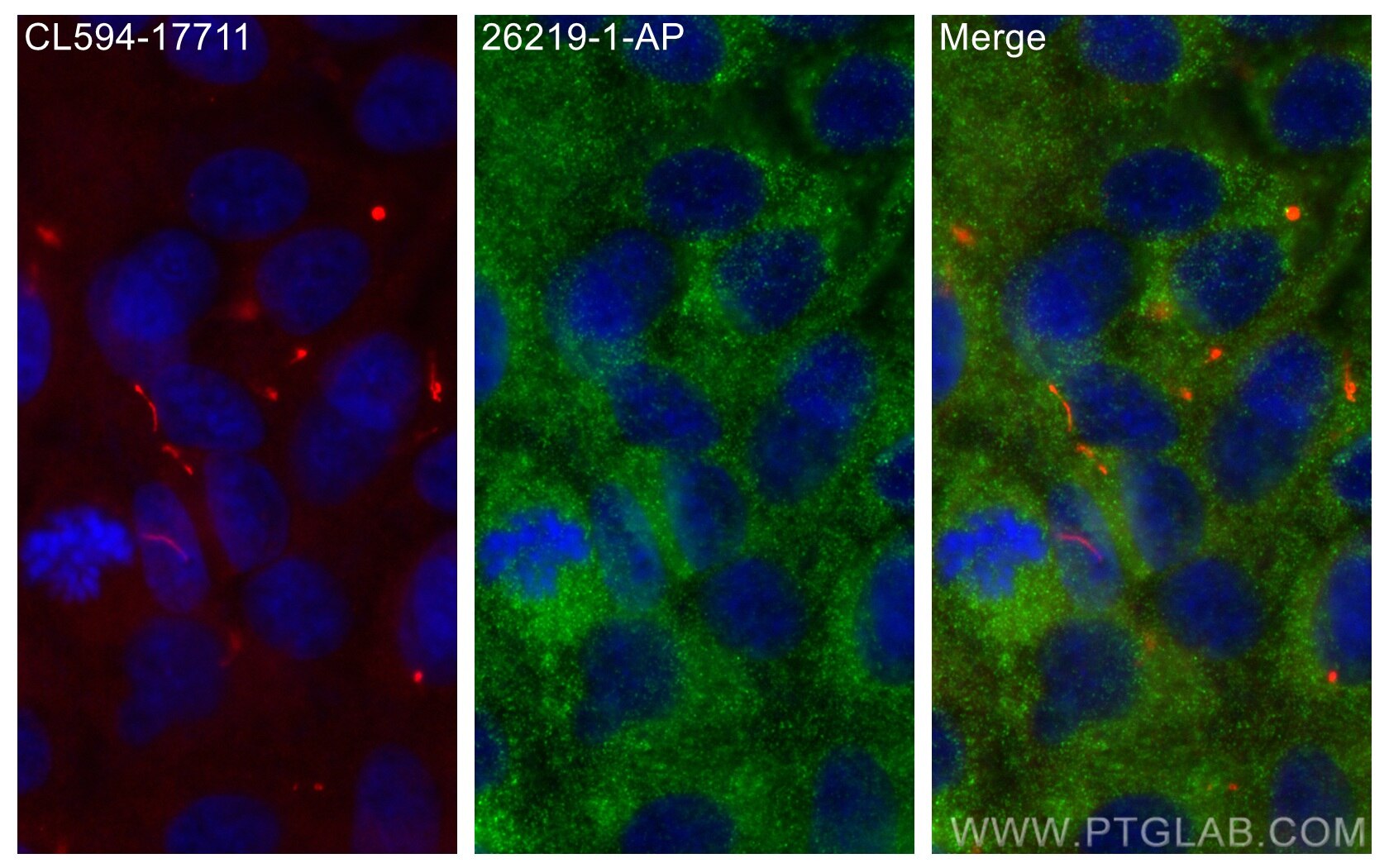 Immunofluorescence (IF) / fluorescent staining of hTERT-RPE1 cells using DRC1 Polyclonal antibody (26219-1-AP)