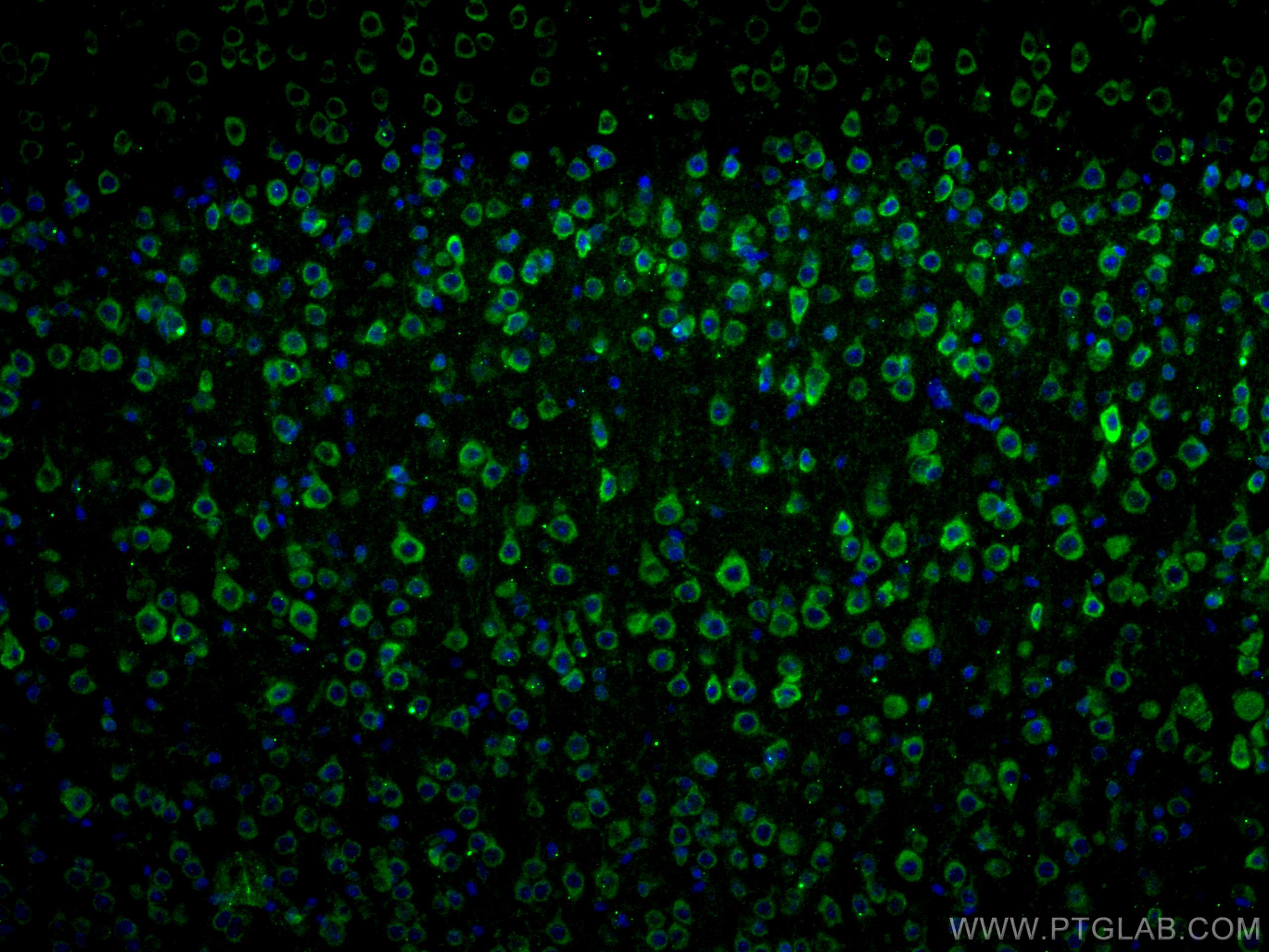 IF Staining of mouse brain using 17934-1-AP