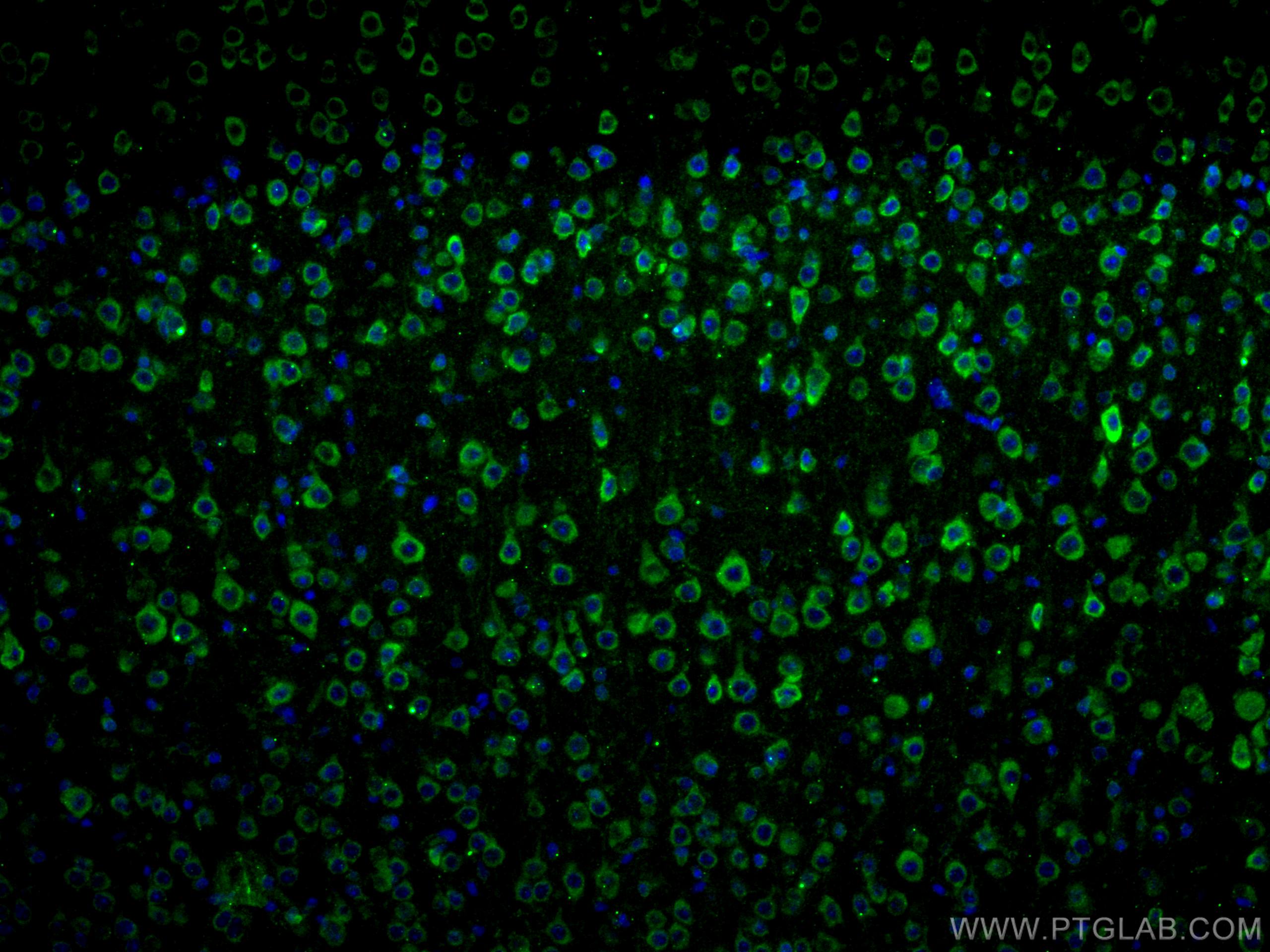 Immunofluorescence (IF) / fluorescent staining of mouse brain tissue using DRD1 Polyclonal antibody (17934-1-AP)