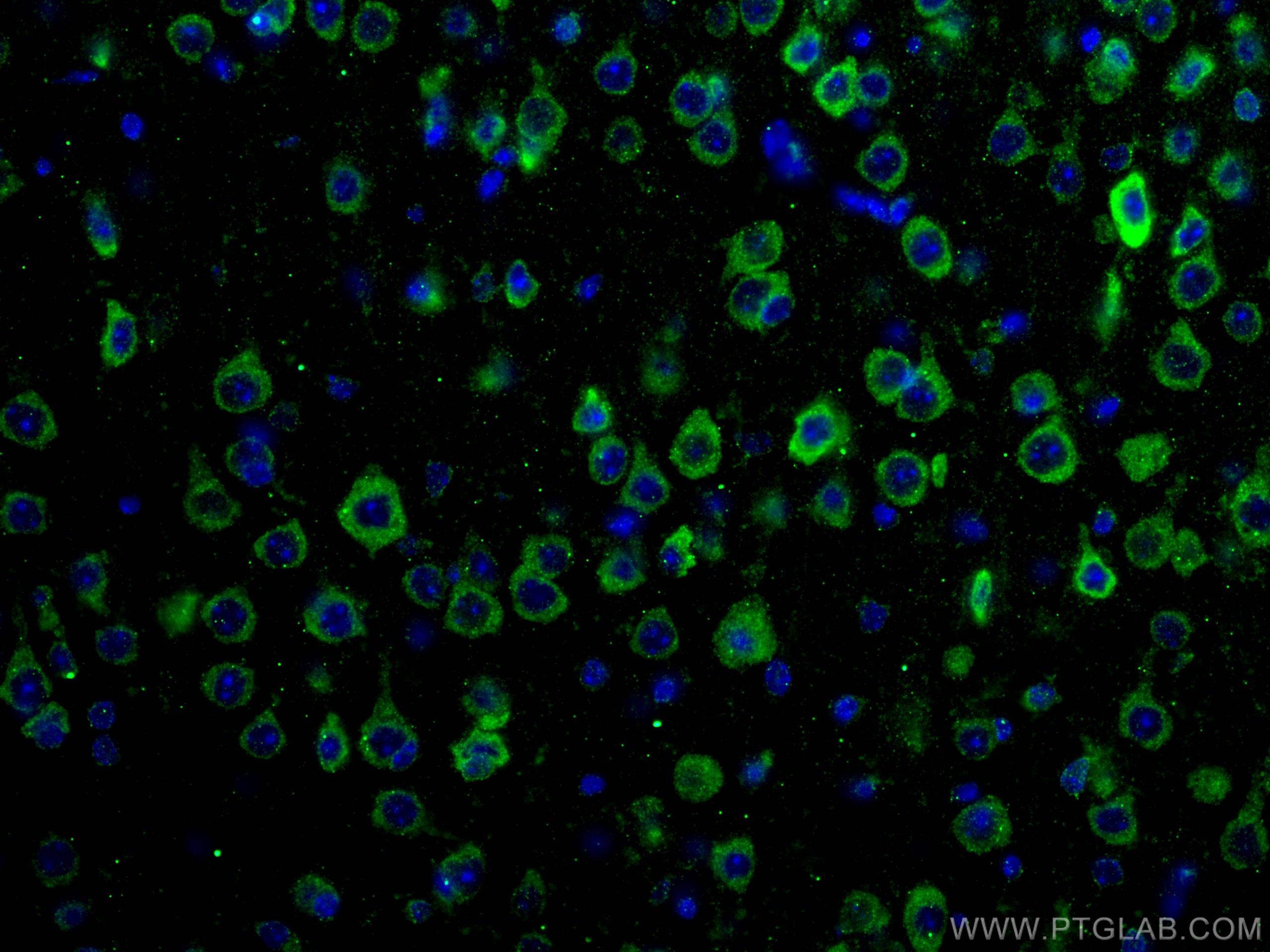 Immunofluorescence (IF) / fluorescent staining of mouse brain tissue using DRD1 Polyclonal antibody (17934-1-AP)