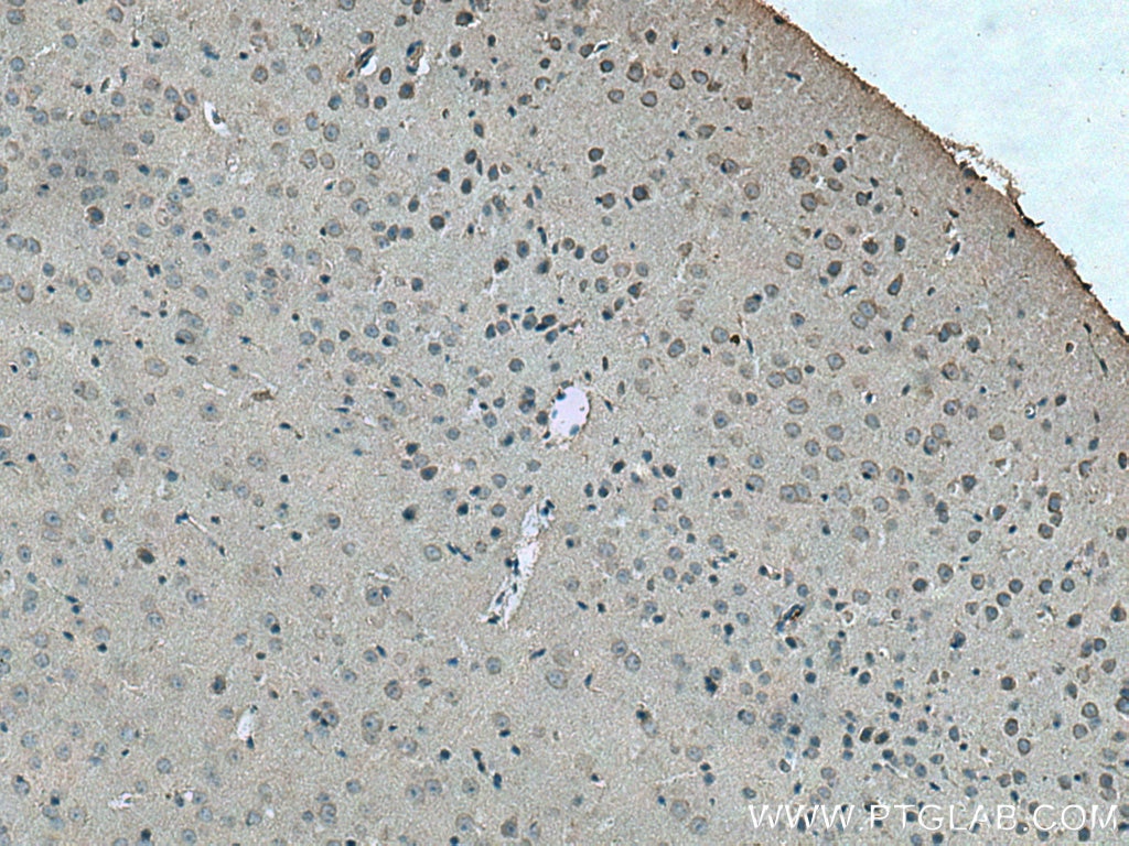 Immunohistochemistry (IHC) staining of mouse brain tissue using DRD1 Polyclonal antibody (17934-1-AP)