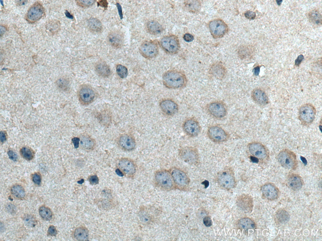 Immunohistochemistry (IHC) staining of mouse brain tissue using DRD1 Polyclonal antibody (17934-1-AP)