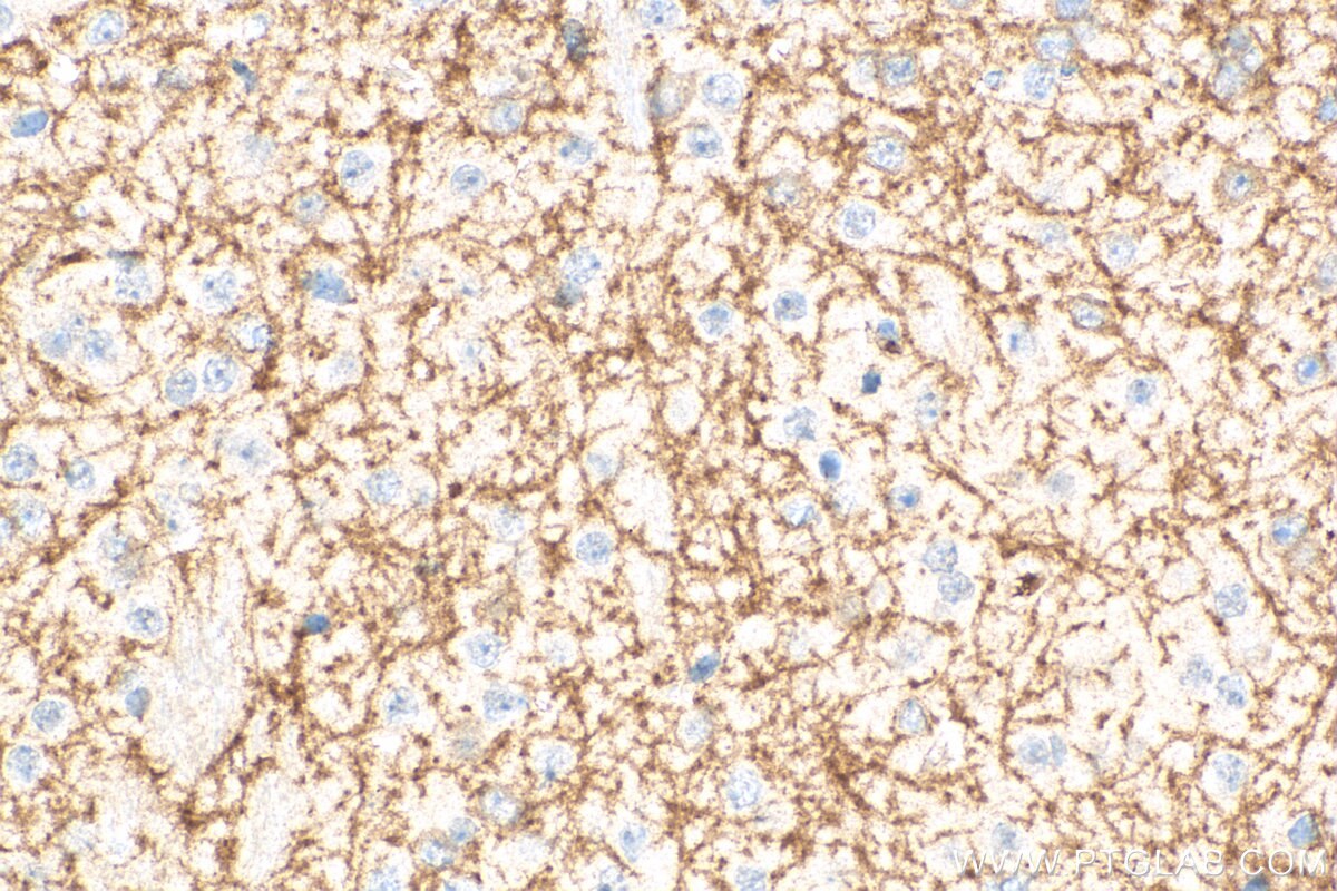 Immunohistochemistry (IHC) staining of mouse brain tissue using DRD1 Polyclonal antibody (17934-1-AP)