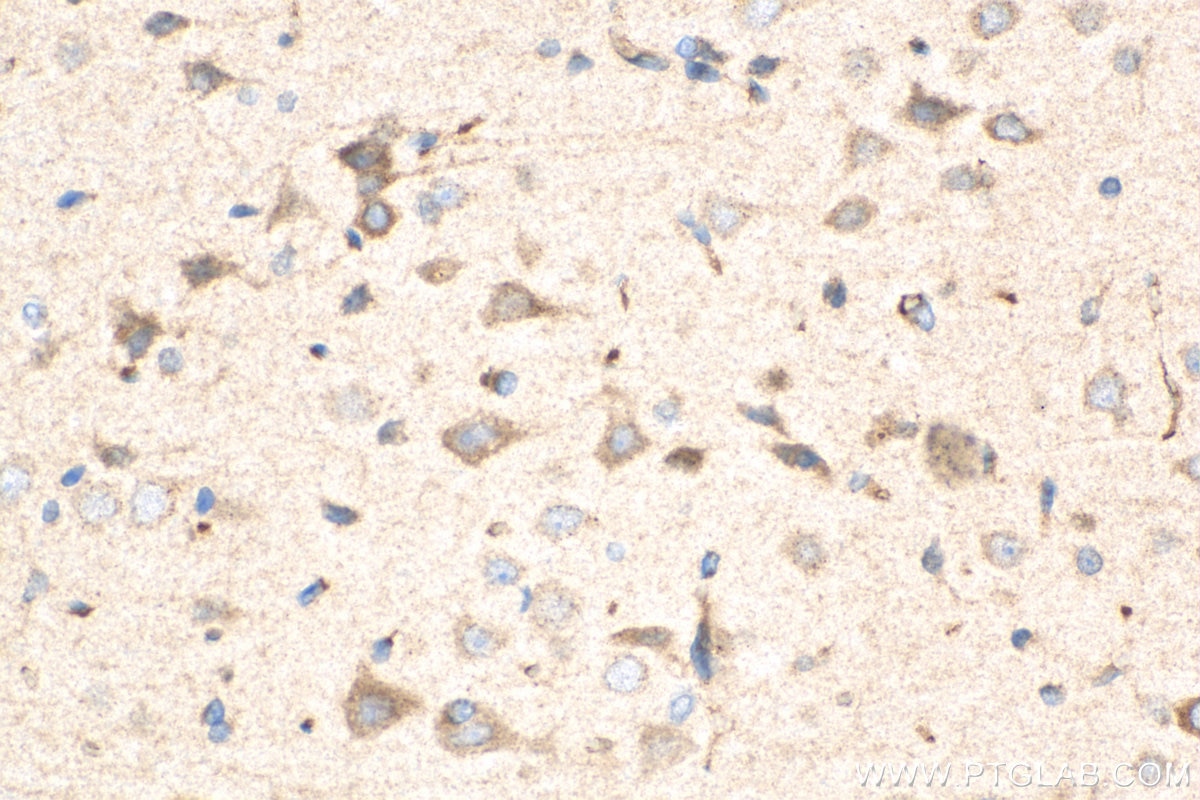 IHC staining of rat brain using 17934-1-AP