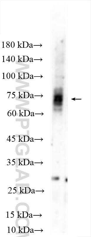 Western Blot (WB) analysis of mouse brain tissue using DRD1 Polyclonal antibody (17934-1-AP)