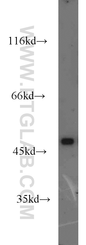 DRD1 Polyclonal antibody