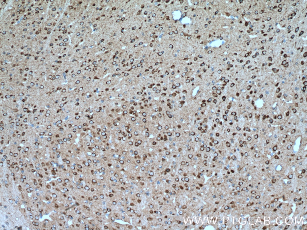 Immunohistochemistry (IHC) staining of mouse brain tissue using DRD2 Polyclonal antibody (22022-1-AP)