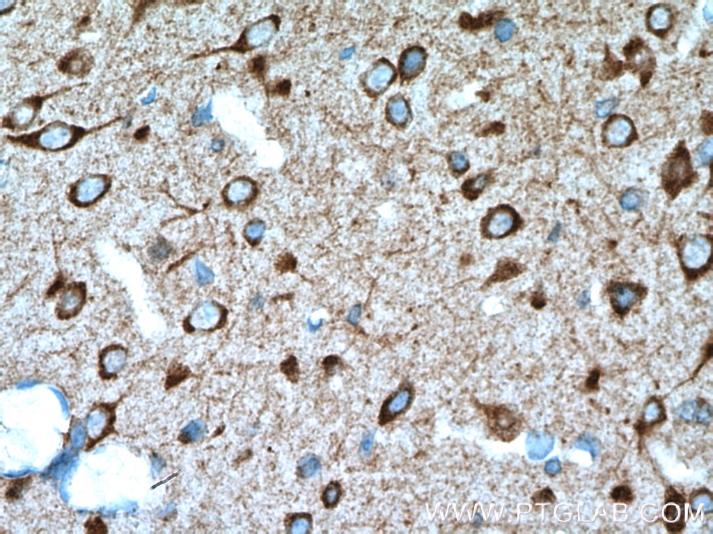 Immunohistochemistry (IHC) staining of mouse brain tissue using DRD2 Polyclonal antibody (22022-1-AP)