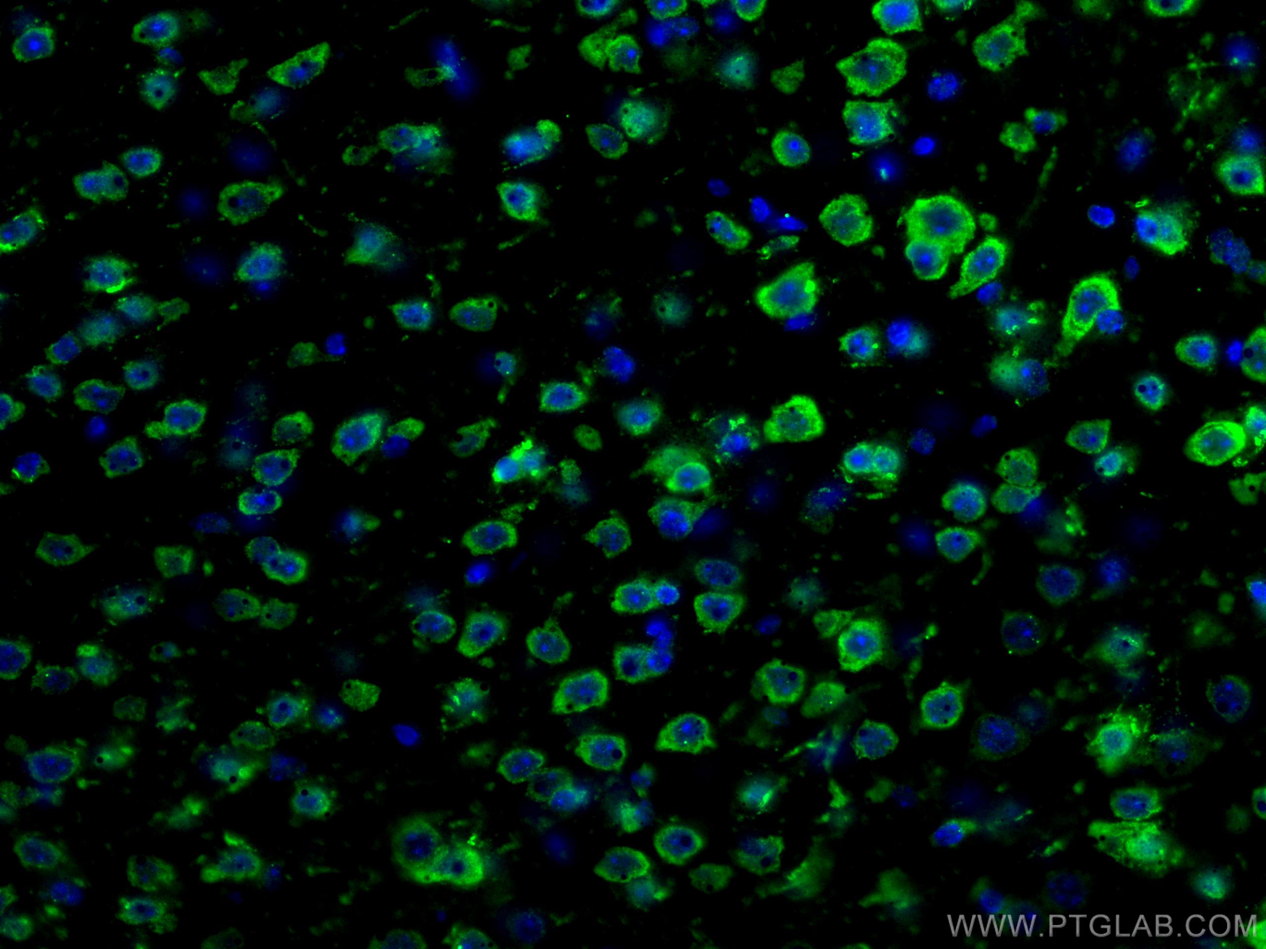 Immunofluorescence (IF) / fluorescent staining of mouse brain tissue using DRD2 Polyclonal antibody (55084-1-AP)