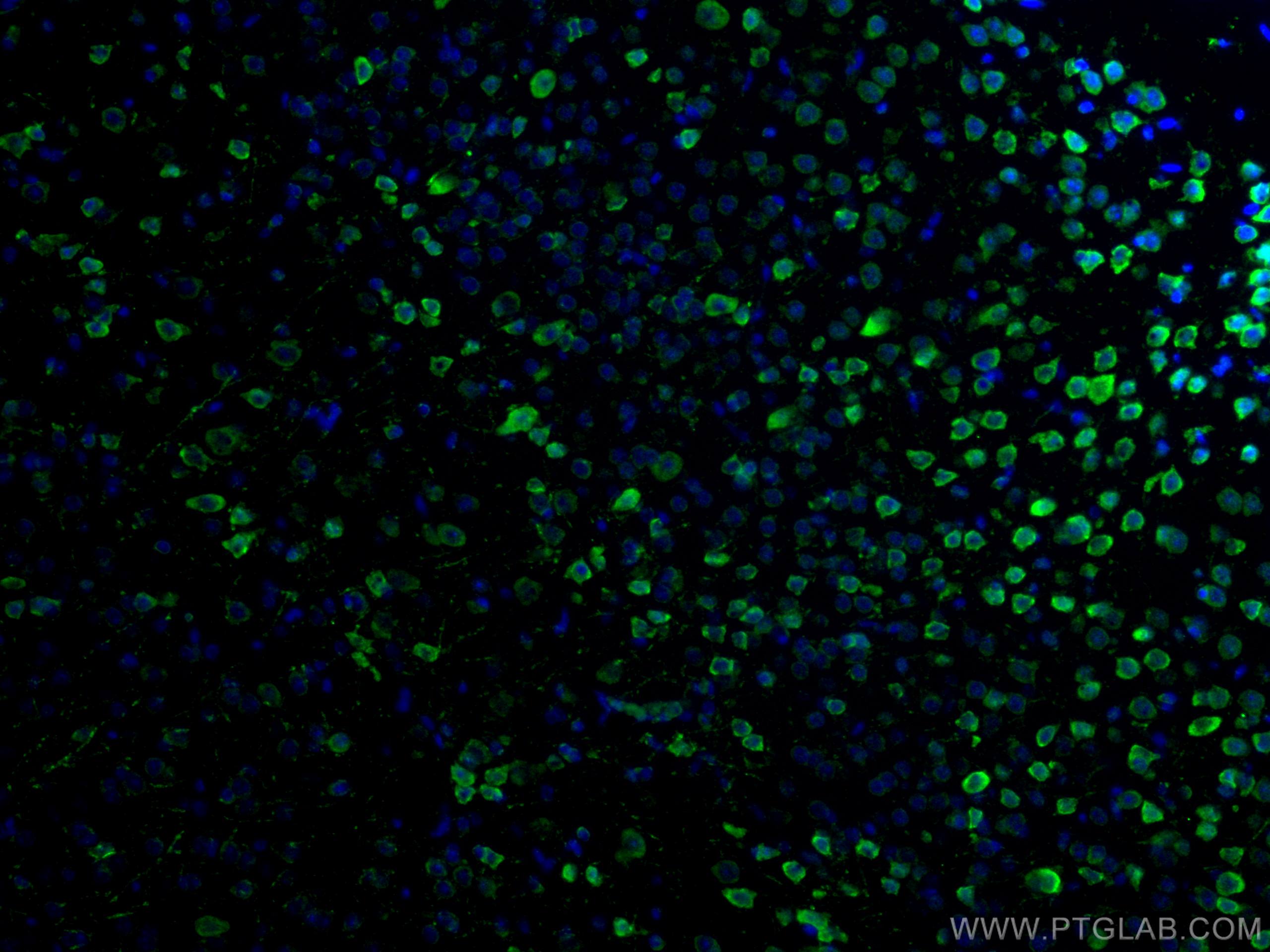 IF Staining of mouse brain using 55084-1-AP