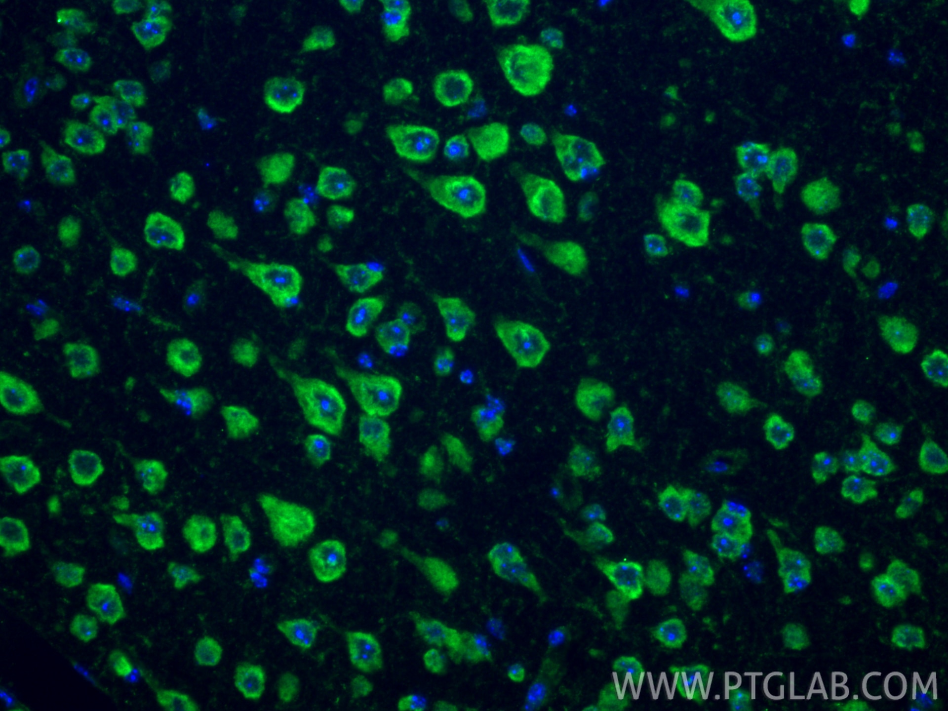 Immunofluorescent analysis of (4% PFA) fixed paraffin-embedded mouse brain tissue using DRD2 antibody (55084-1-AP) at dilution of 1:200 and CoraLite®488-Conjugated Goat Anti-Rabbit IgG(H+L) (SA00013-2). Heat mediated antigen retrieval with Tris-EDTA buffer (pH 9.0). Immunofluorescence (IF) / fluorescent staining of mouse brain tissue using DRD2 Polyclonal antibody (55084-1-AP)