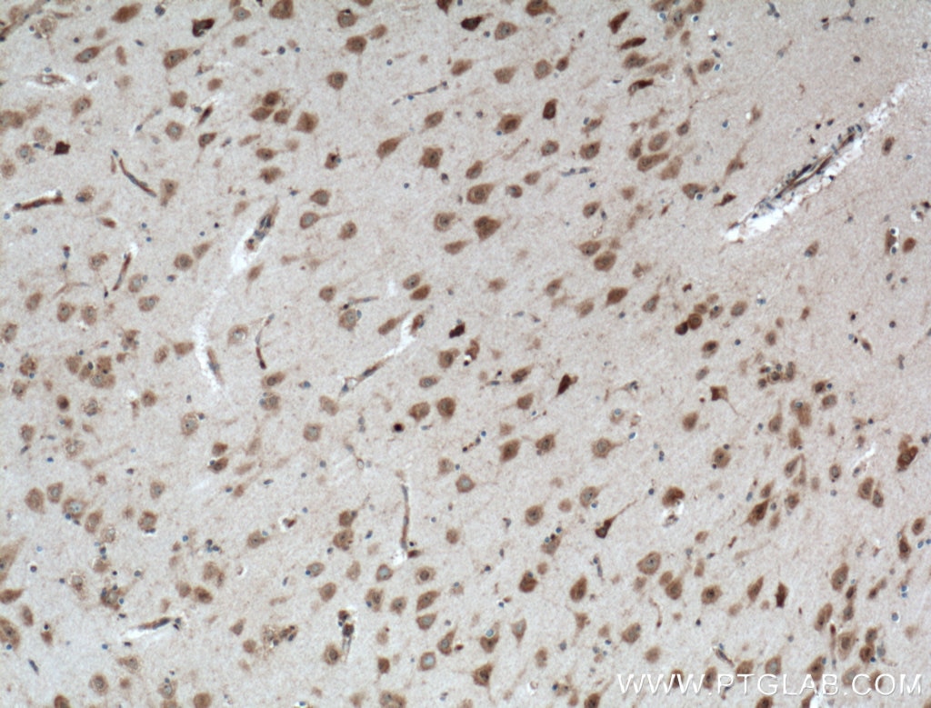IHC staining of human brain using 55084-1-AP