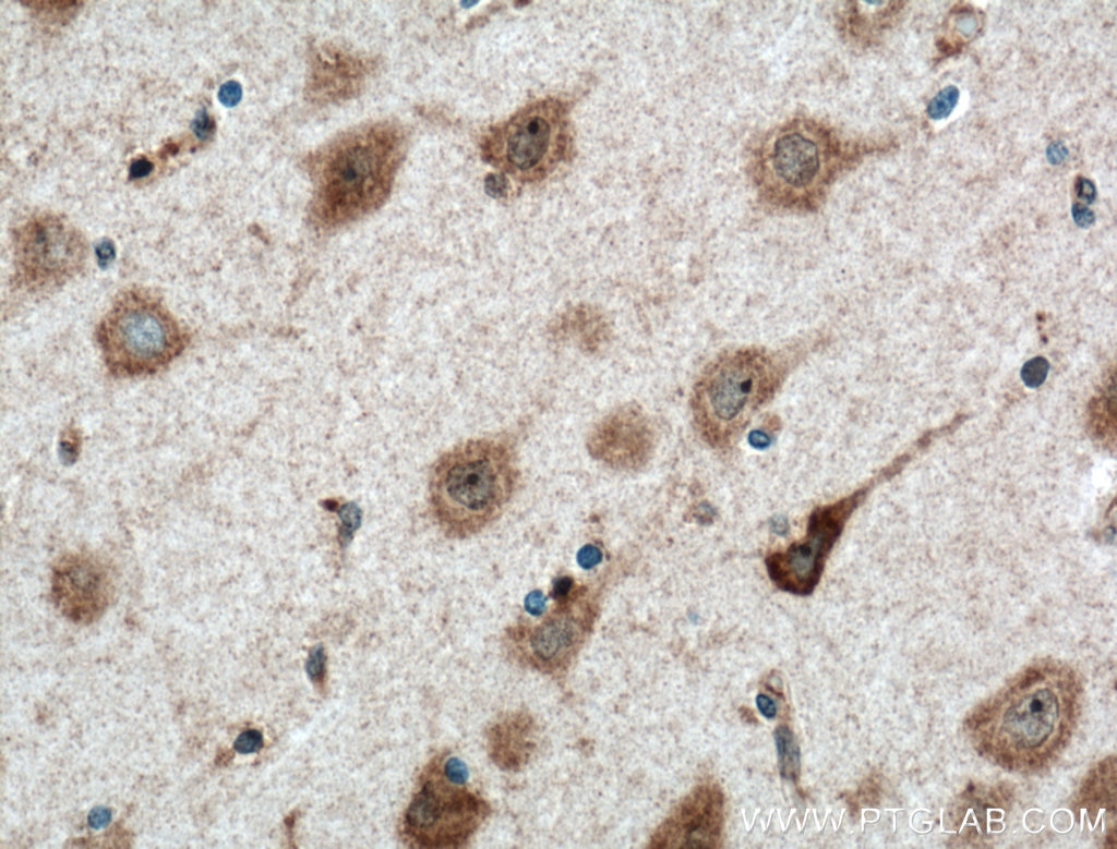 IHC staining of human brain using 55084-1-AP