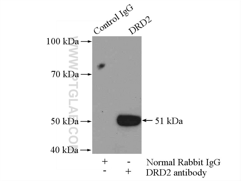 Immunoprecipitation (IP) experiment of SH-SY5Y cells using DRD2 Polyclonal antibody (55084-1-AP)