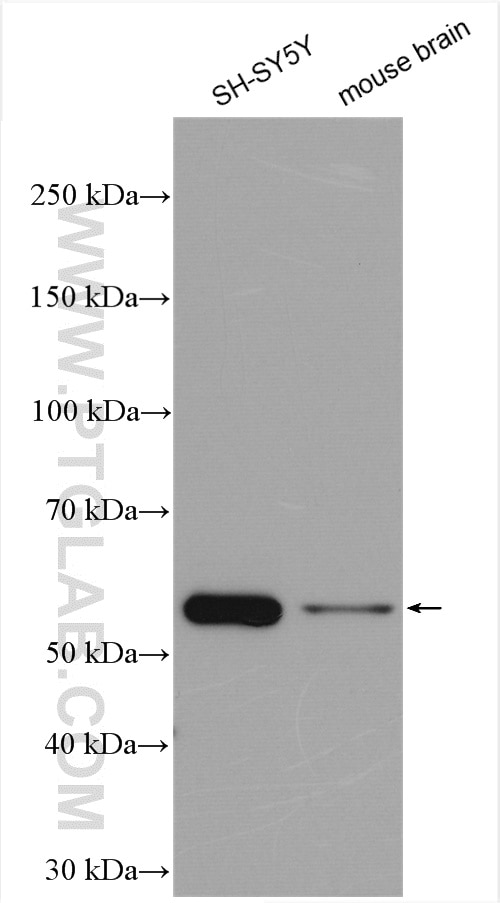 Western Blot (WB) analysis of various lysates using DRD2 Polyclonal antibody (55084-1-AP)