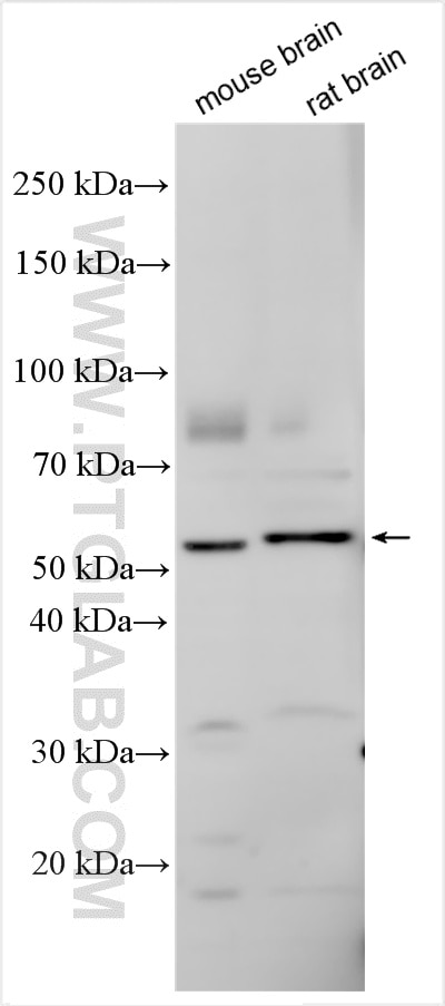 Western Blot (WB) analysis of various lysates using DRD2 Polyclonal antibody (55084-1-AP)