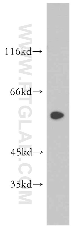 DRD2 Polyclonal antibody