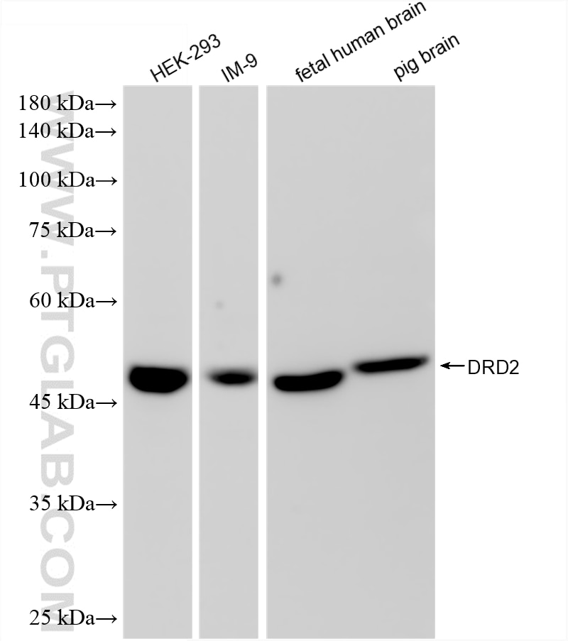 WB analysis using 88509-1-RR Western Blot (WB) analysis of various lysates using DRD2 Recombinant monoclonal antibody (88509-1-RR)