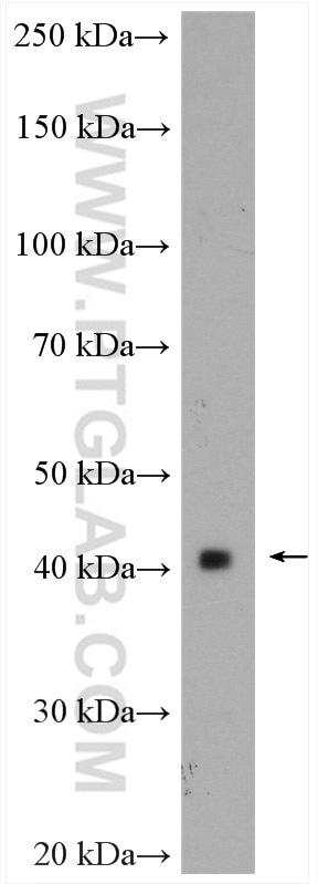 Western Blot (WB) analysis of pig brain tissue using DRD4 Polyclonal antibody (28094-1-AP)