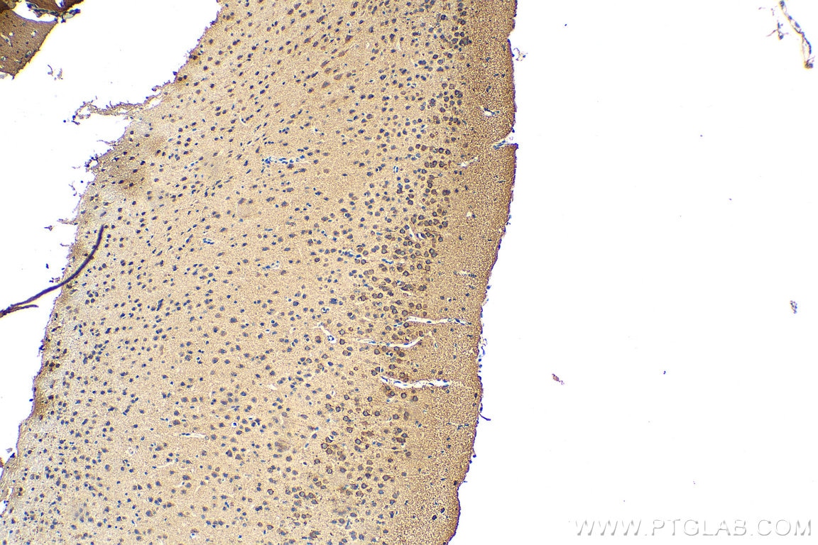 Immunohistochemistry (IHC) staining of mouse brain tissue using DRD5 Polyclonal antibody (20310-1-AP)