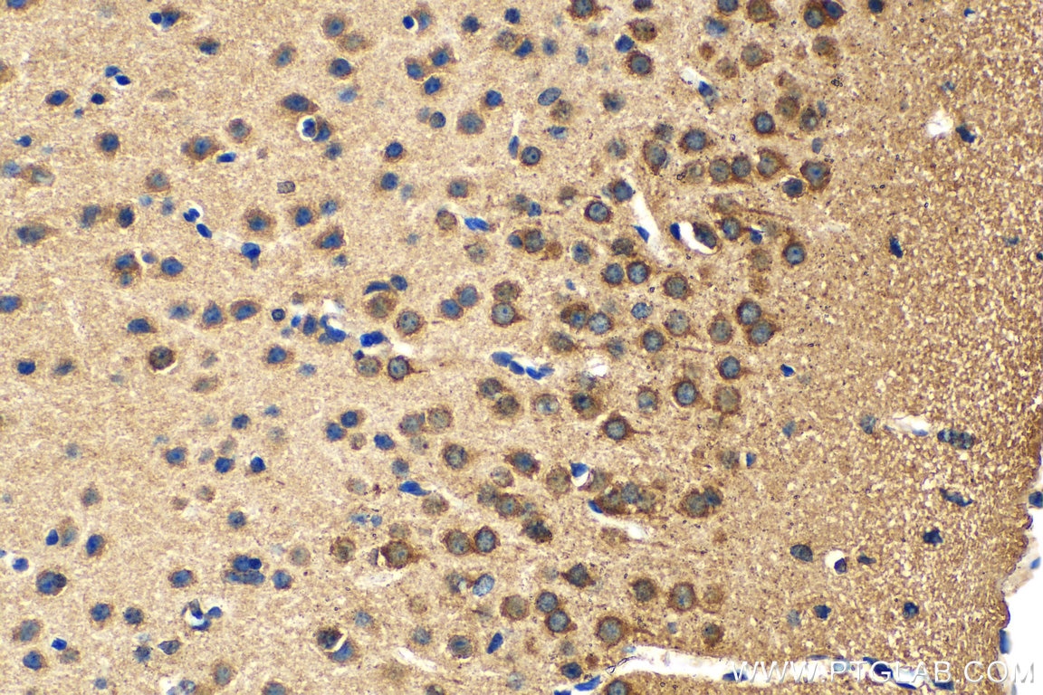 IHC staining of mouse brain using 20310-1-AP
