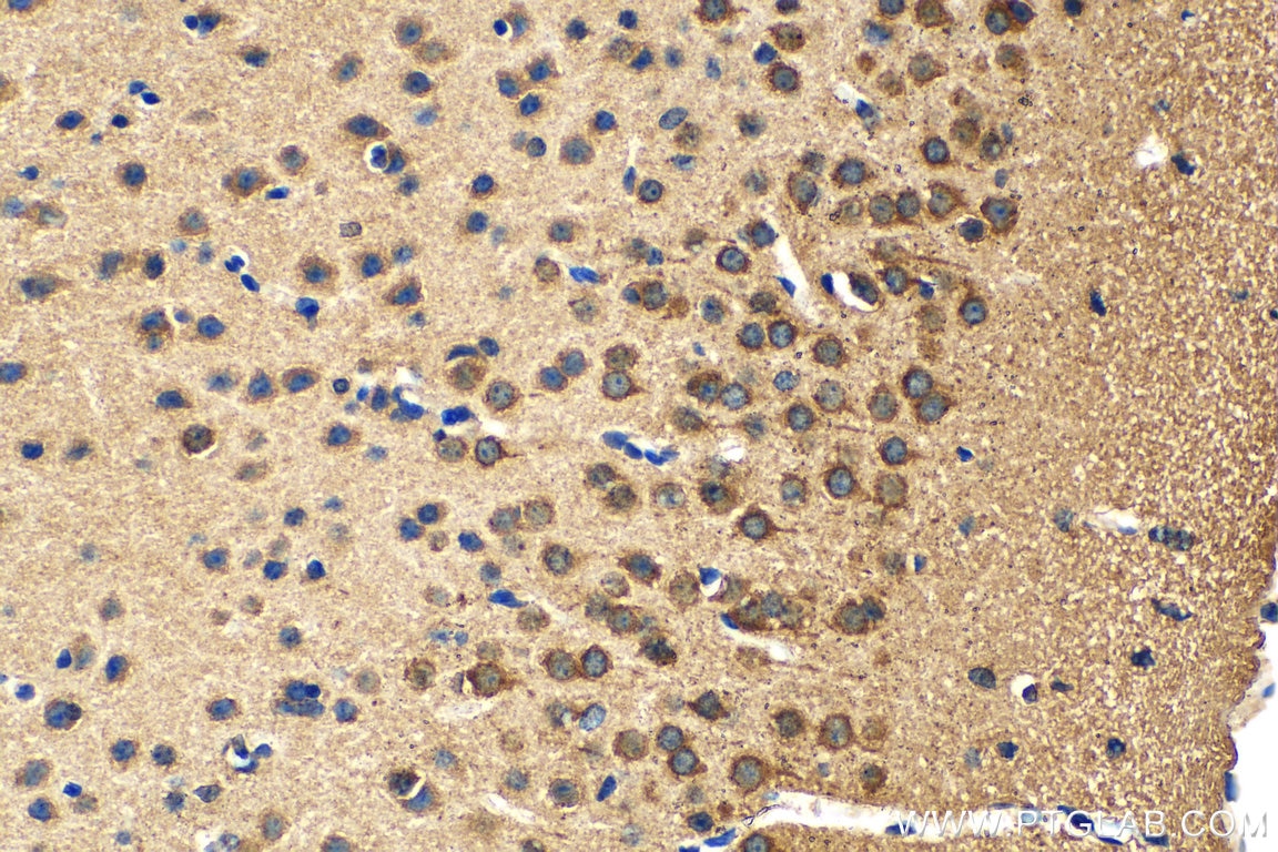 Immunohistochemistry (IHC) staining of mouse brain tissue using DRD5 Polyclonal antibody (20310-1-AP)