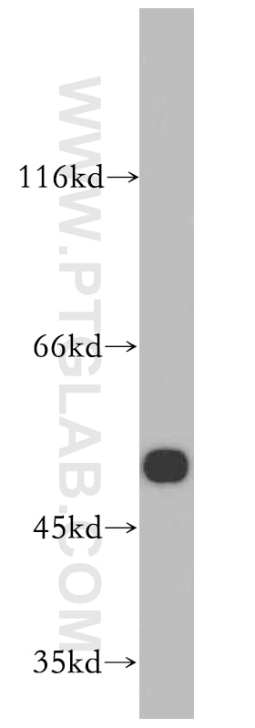 Western Blot (WB) analysis of mouse brain tissue using DRD5 Polyclonal antibody (20310-1-AP)