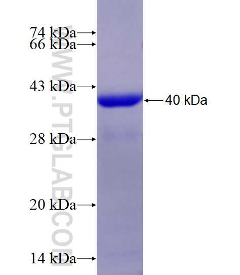 DRD5 fusion protein Ag14145 SDS-PAGE