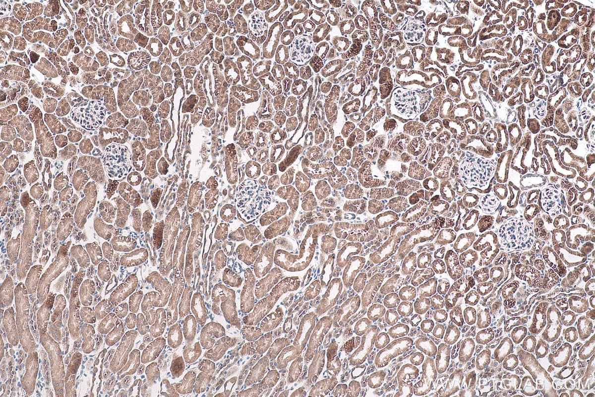 Immunohistochemistry (IHC) staining of mouse kidney tissue using DRG1 Polyclonal antibody (13190-1-AP)