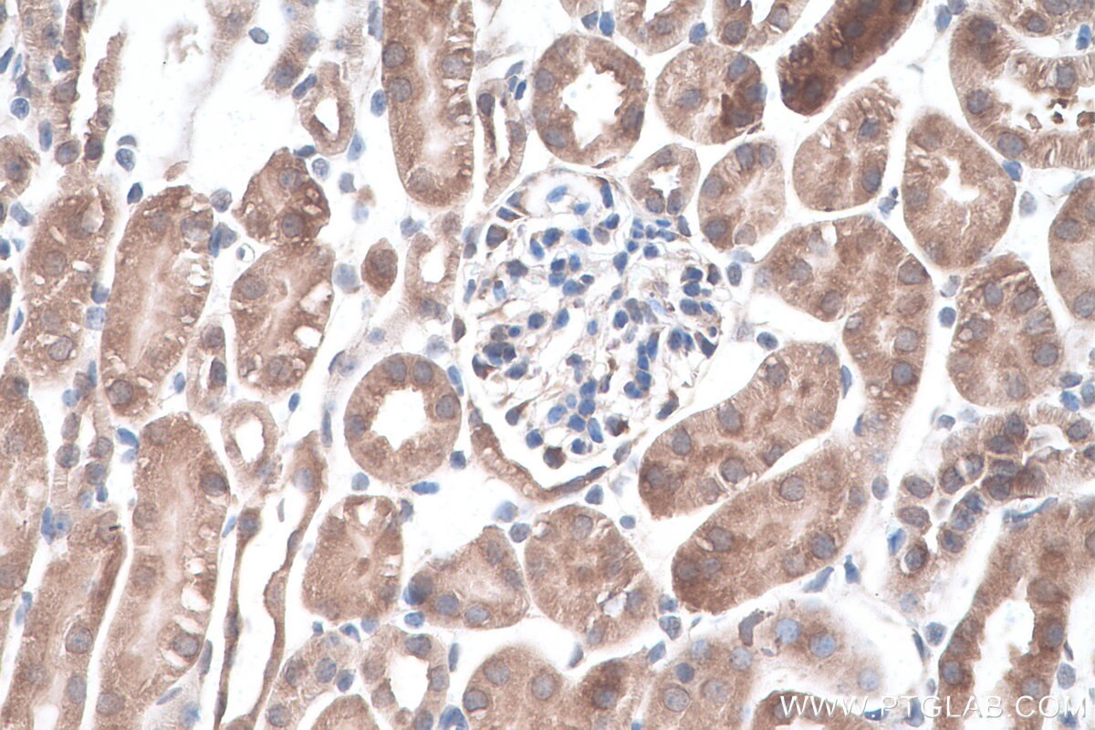 Immunohistochemistry (IHC) staining of mouse kidney tissue using DRG1 Polyclonal antibody (13190-1-AP)