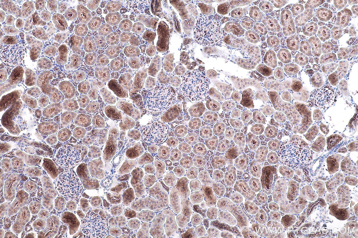 Immunohistochemistry (IHC) staining of rat kidney tissue using DRG1 Polyclonal antibody (13190-1-AP)