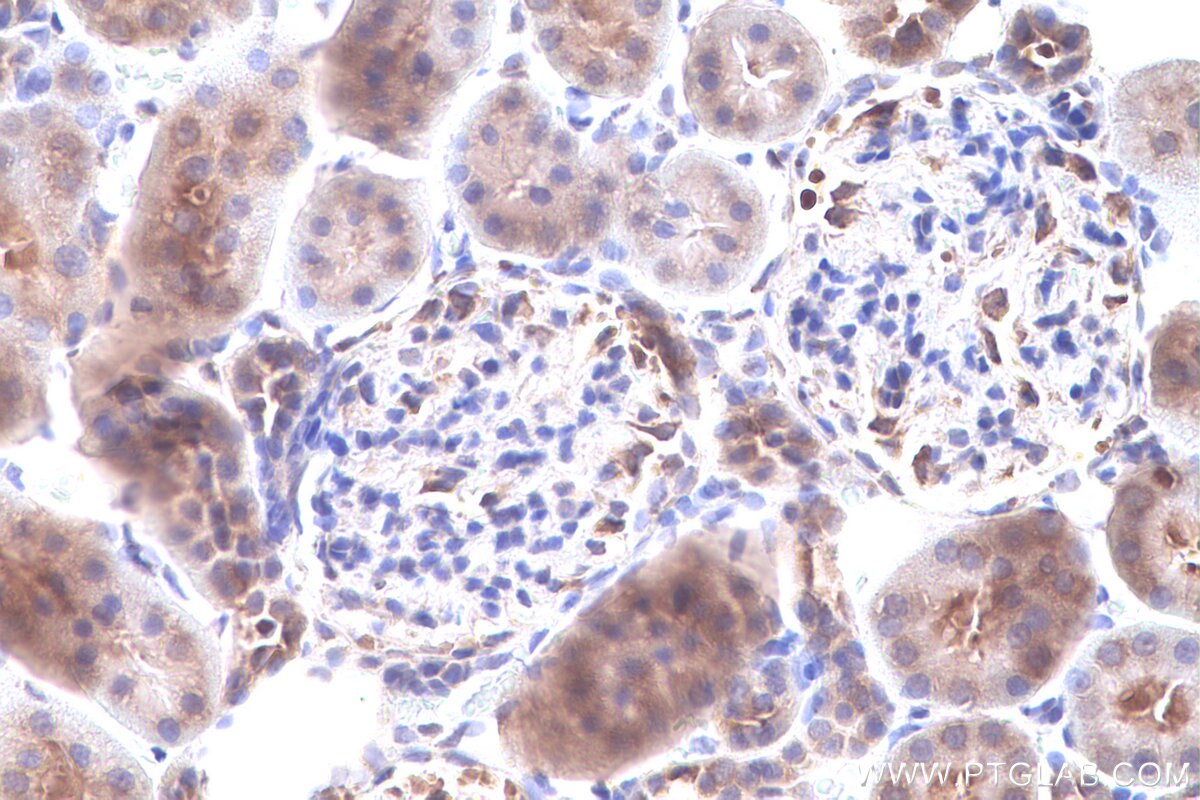 Immunohistochemistry (IHC) staining of rat kidney tissue using DRG1 Polyclonal antibody (13190-1-AP)