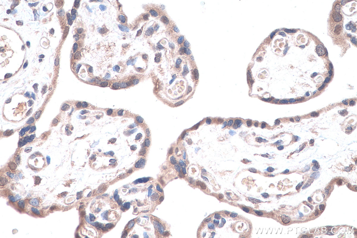 IHC staining of human placenta using 13190-1-AP