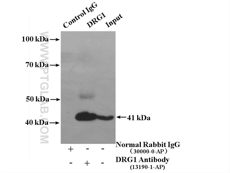 Immunoprecipitation (IP) experiment of K-562 cells using DRG1 Polyclonal antibody (13190-1-AP)