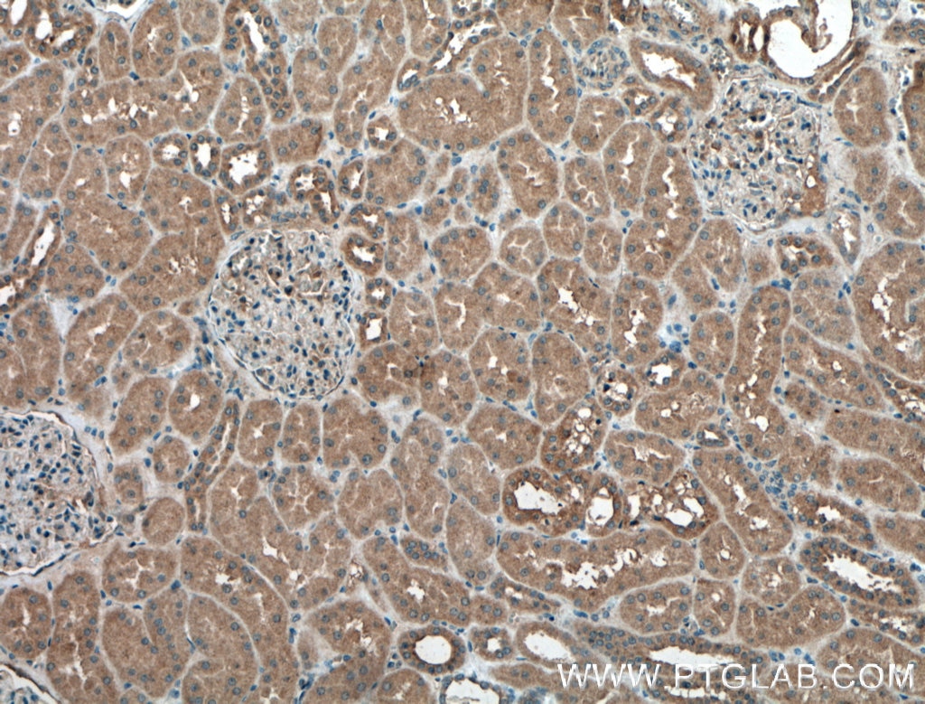 Immunohistochemistry (IHC) staining of human kidney tissue using DRG2 Polyclonal antibody (14743-1-AP)