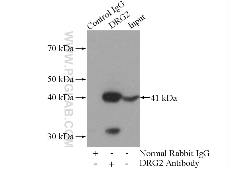 Immunoprecipitation (IP) experiment of mouse brain tissue using DRG2 Polyclonal antibody (14743-1-AP)