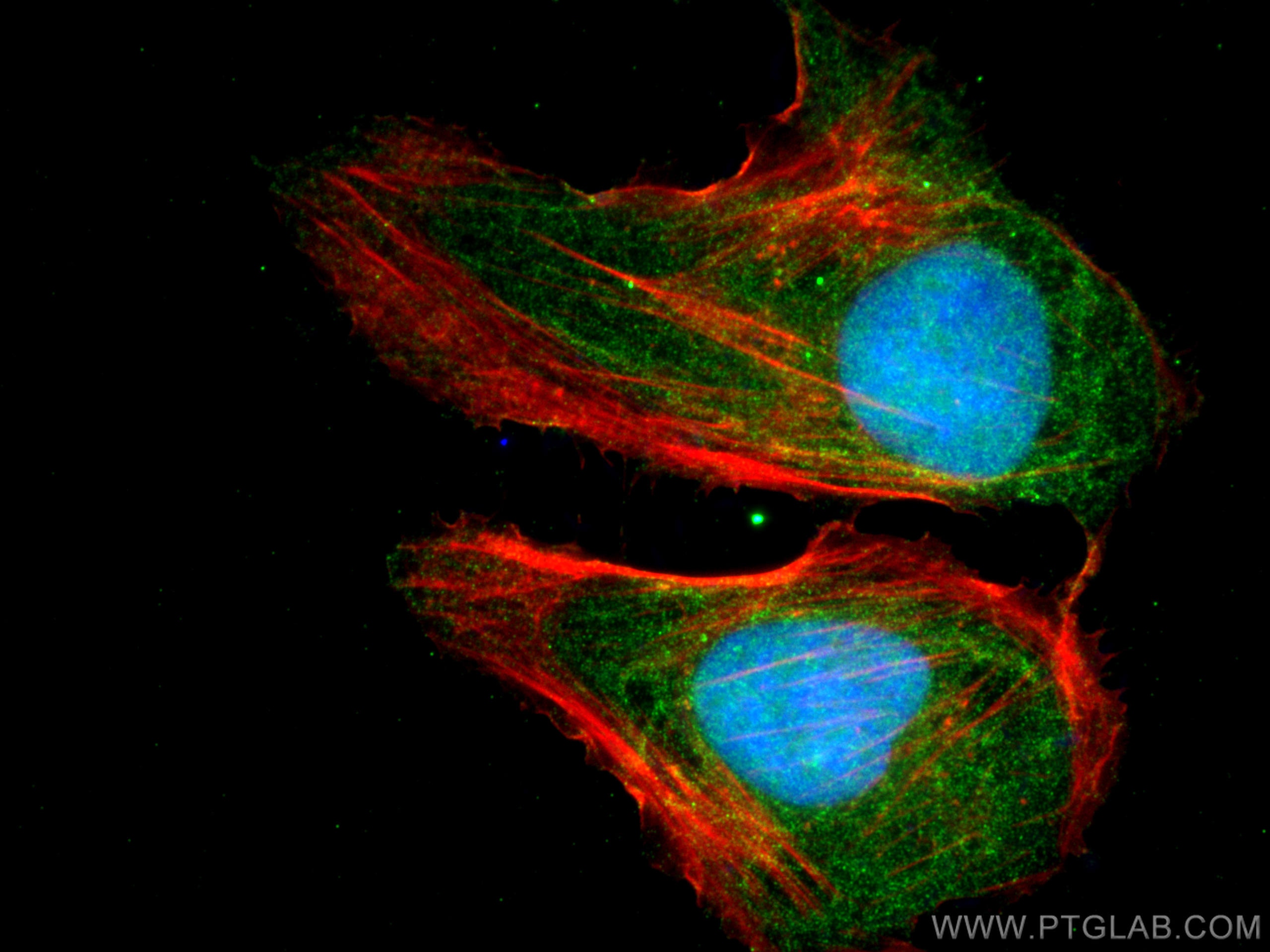 Immunofluorescence (IF) / fluorescent staining of U2OS cells using DROSHA Polyclonal antibody (27958-1-AP)