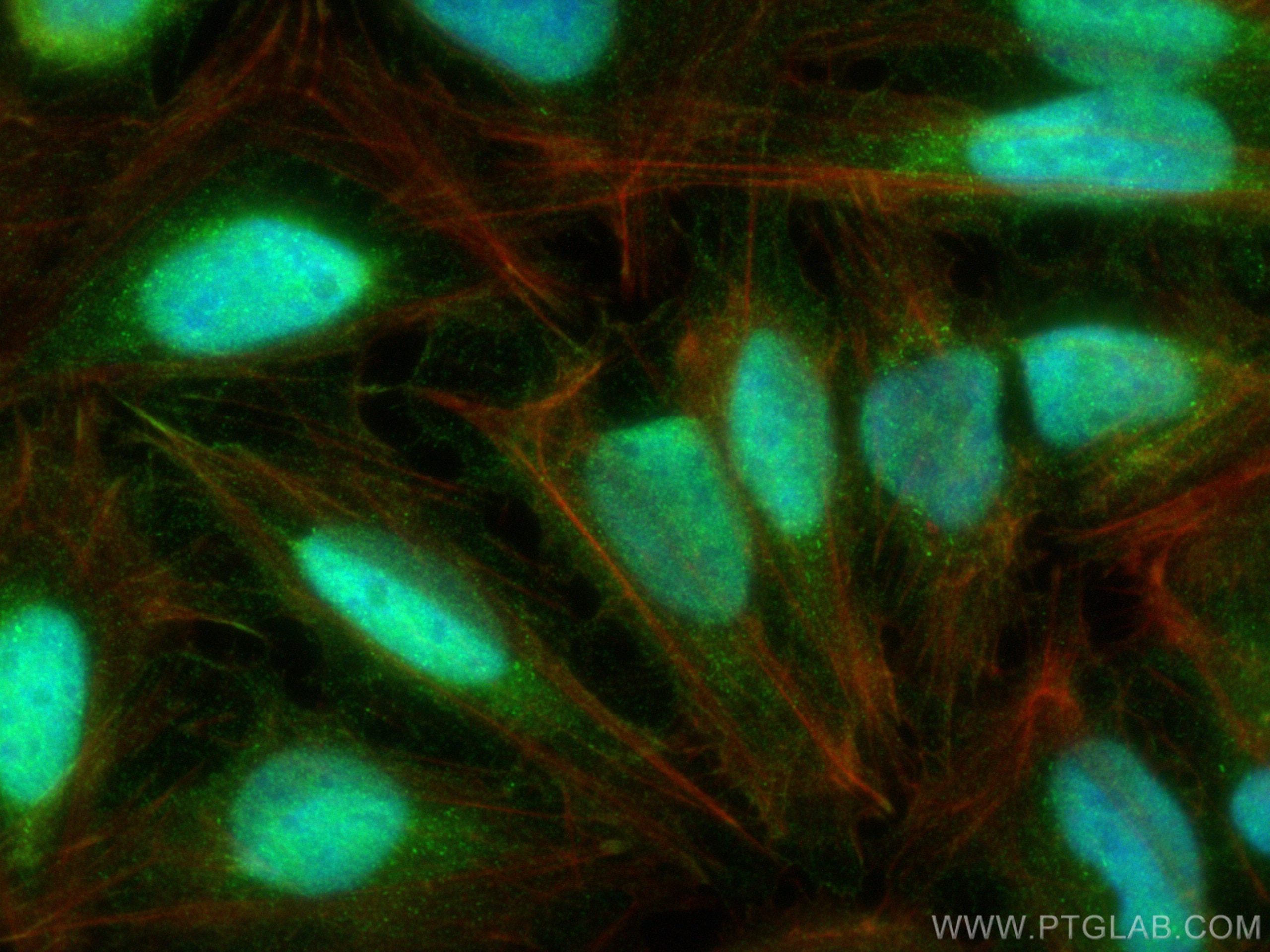 Immunofluorescence (IF) / fluorescent staining of U2OS cells using DROSHA Polyclonal antibody (27958-1-AP)