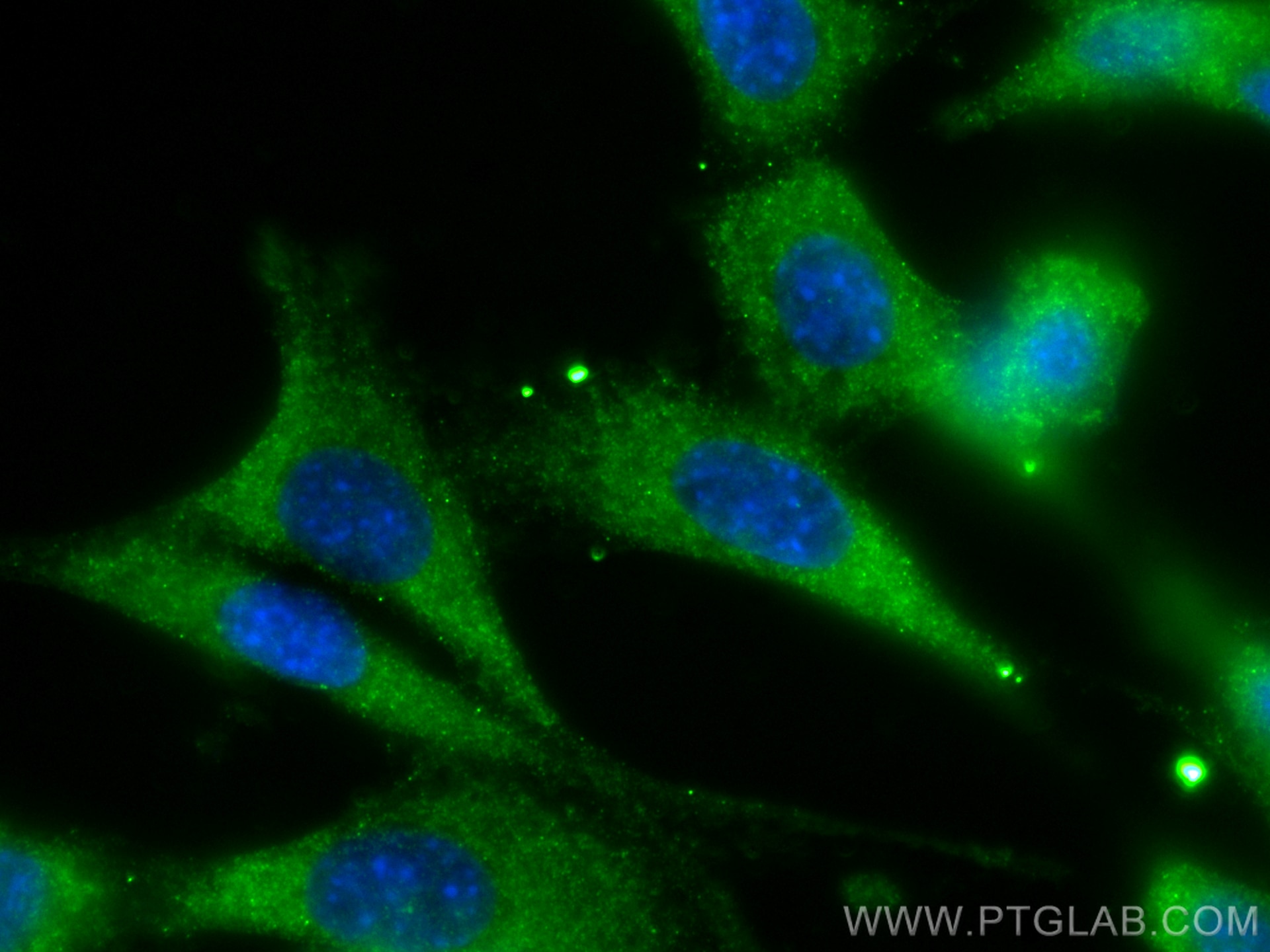 Immunofluorescence (IF) / fluorescent staining of NIH/3T3 cells using DRP1 (C-terminal) Recombinant antibody (81561-1-RR)