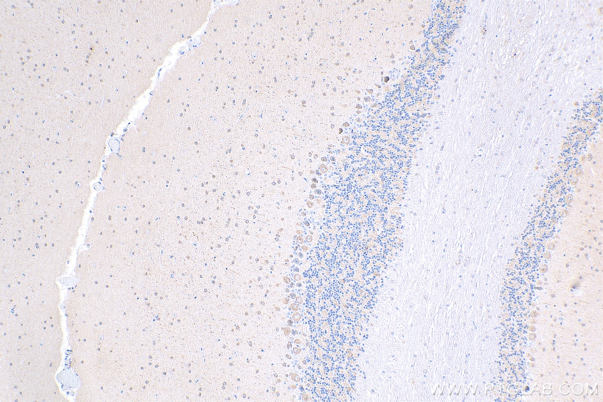 Immunohistochemistry (IHC) staining of mouse cerebellum tissue using DRP1 (C-terminal) Recombinant antibody (81561-1-RR)