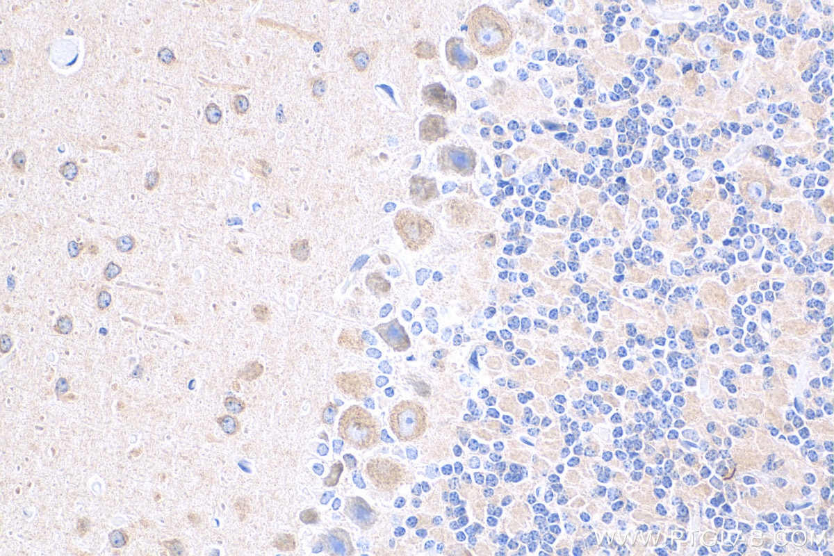 Immunohistochemistry (IHC) staining of mouse cerebellum tissue using DRP1 (C-terminal) Recombinant antibody (81561-1-RR)