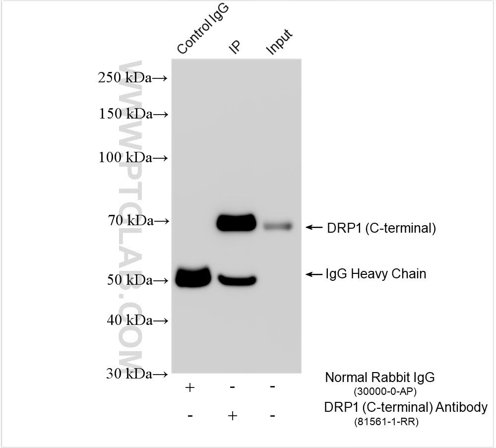 Immunoprecipitation (IP) experiment of PC-12 cells using DRP1 (C-terminal) Recombinant antibody (81561-1-RR)