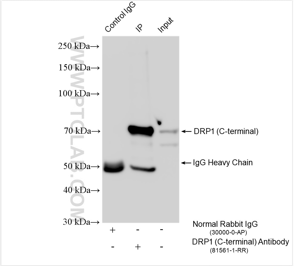 Immunoprecipitation (IP) experiment of rat brain tissue using DRP1 (C-terminal) Recombinant antibody (81561-1-RR)