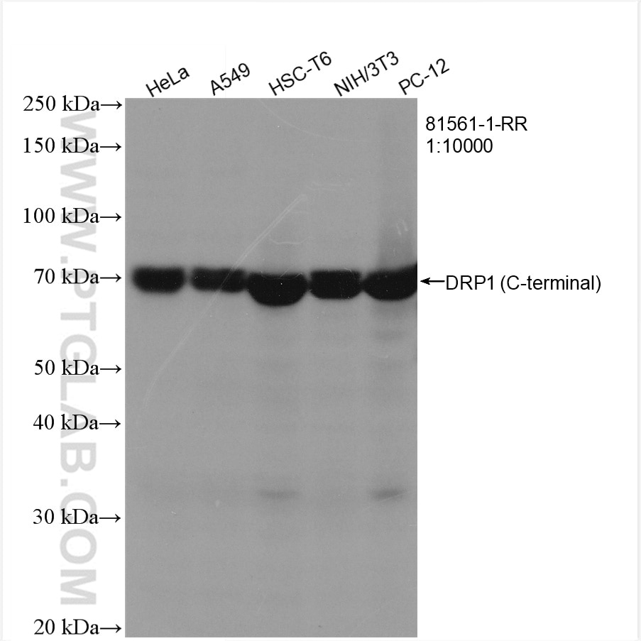 Western Blot (WB) analysis of various lysates using DRP1 (C-terminal) Recombinant antibody (81561-1-RR)