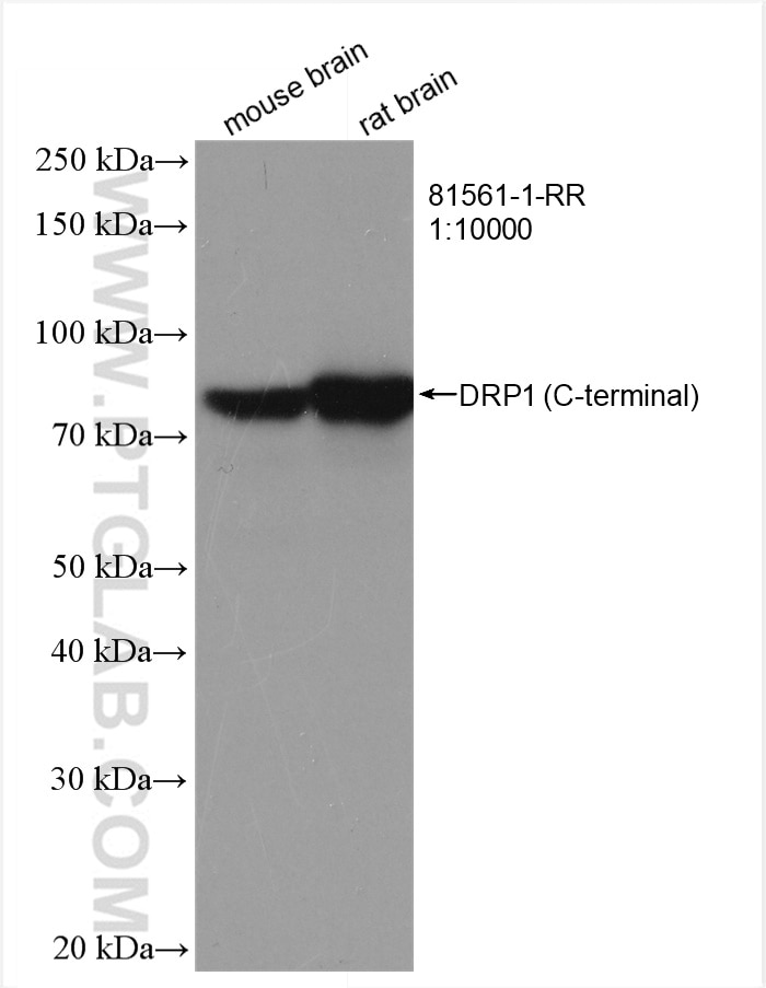 Western Blot (WB) analysis of various lysates using DRP1 (C-terminal) Recombinant antibody (81561-1-RR)