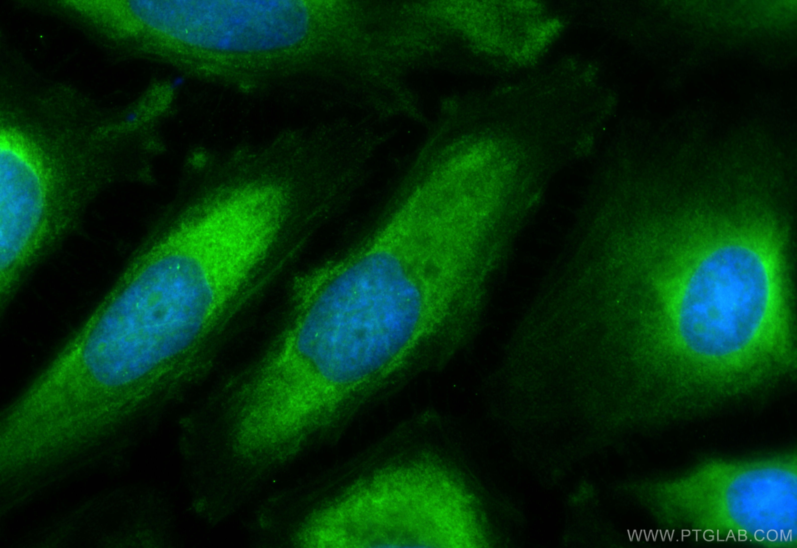 Immunofluorescence (IF) / fluorescent staining of HeLa cells using CoraLite® Plus 488-conjugated DRP1 (C-terminal) Po (CL488-12957)