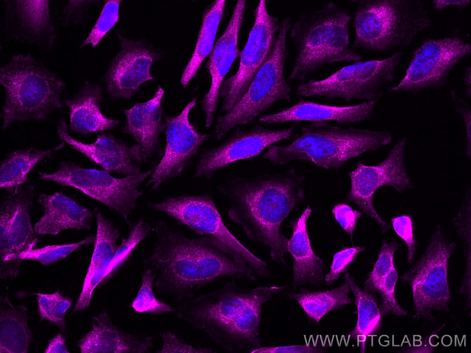 Immunofluorescence (IF) / fluorescent staining of HeLa cells using CoraLite® Plus 647-conjugated DRP1 (C-terminal) Po (CL647-12957)