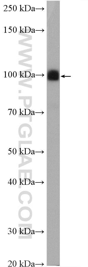 Western Blot (WB) analysis of rat brain tissue using DRP2 Polyclonal antibody (26631-1-AP)