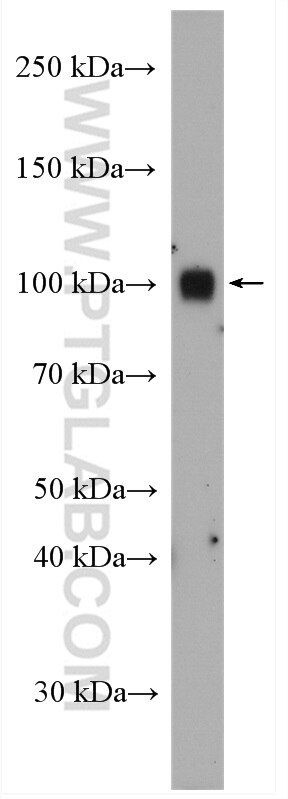 Western Blot (WB) analysis of rat brain tissue using DRP2 Polyclonal antibody (26631-1-AP)
