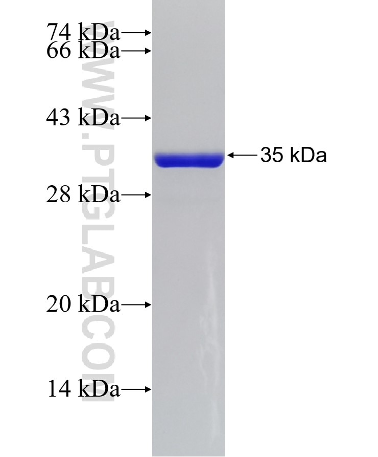 DSC1 fusion protein Ag25822 SDS-PAGE